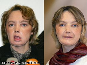 art.isabelle.dinoire.face.gi.jpg